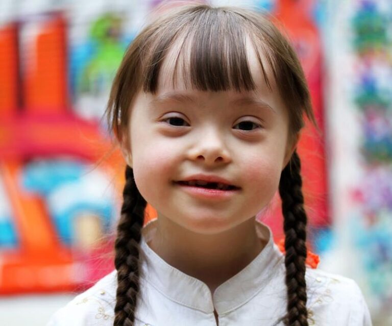 Zespół Downa: Dlaczego Plama Na Koszuli Może Kryć Szersze Znaczenie